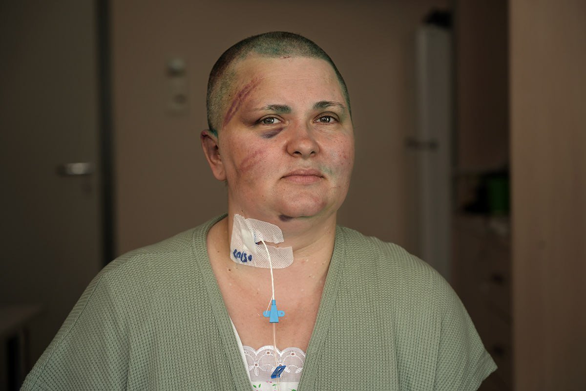Заставляли есть землю: журналистка Елена Милашина рассказала, как её избили в Чечне