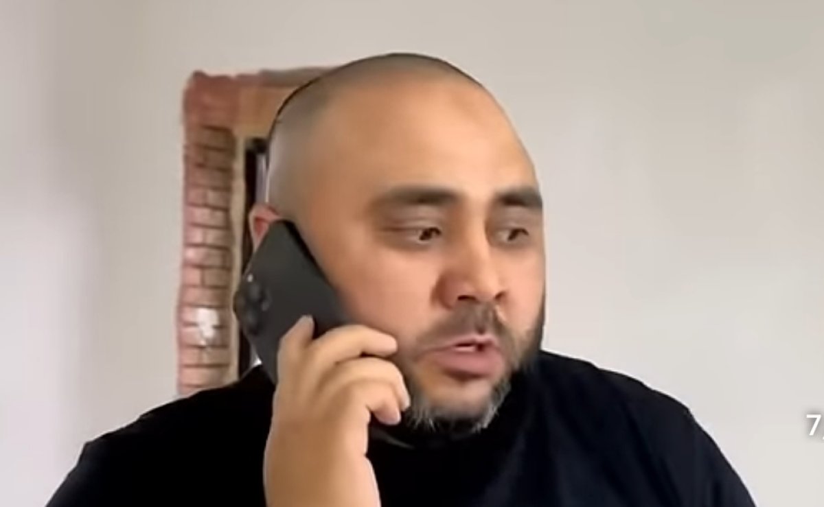 Вайнер Сека признался, что сделал пересадку волос