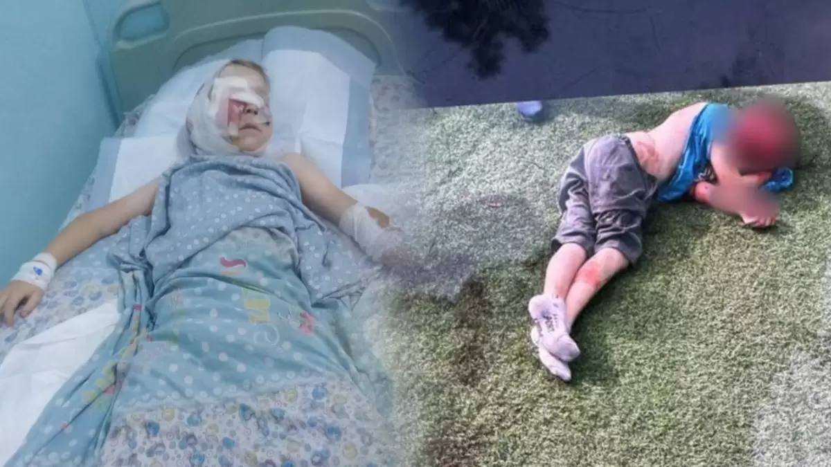 "Ждем лучших результатов": что известно о состоянии мальчика, на которого напали собаки под Алматы