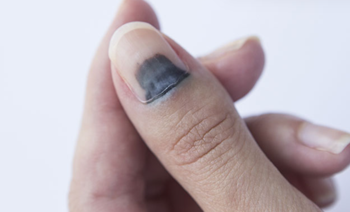 Рак, который видно сразу: на что обратить внимание