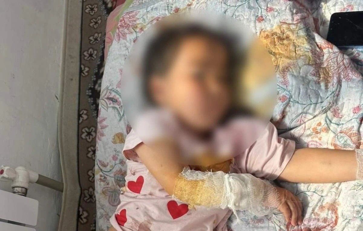 Шакал покусал ребёнка и двух взрослых в Туркестанской области