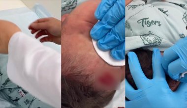 Кровопускание и младенец: глава минздрава пообещала проверку