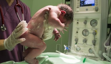 Удручающая статистика: сколько новорожденных в Казахстане рождаются с риском развития слепоты