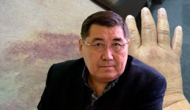 Опухли руки: депутат Ермурат Бапи заявил о подозрении на отравление