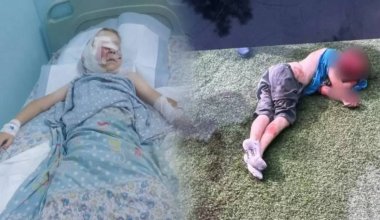 "Ждем лучших результатов": что известно о состоянии мальчика, на которого напали собаки под Алматы