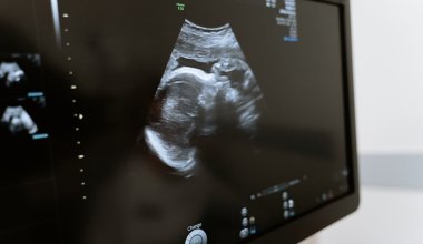 Гинекологи могут появиться в казахстанских школах из-за беременностей подростков