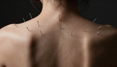 Иглоукалывание едва не привело к трагедии в Казахстане