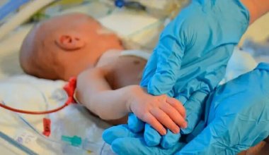 Дети с корью попали в реанимацию в Актобе